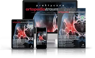 Praktyczna ortopedia i traumatologia